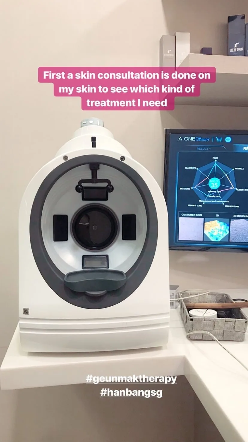 Instagram story: a skin analysis machine, captioned 'First a skin consultation is done on my skin to see which kind of treatment I need'